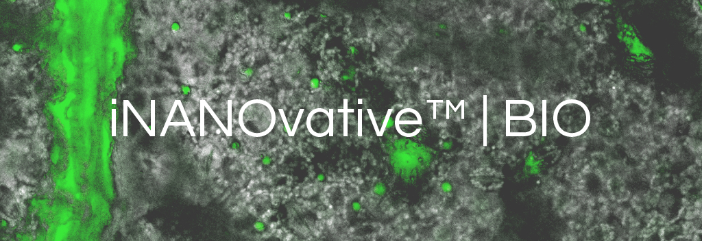 Confocal microscopy photo of iNANOvative™ | BIO nanoparticle clusters in plant tissue